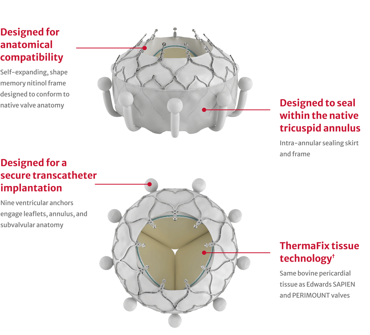 Evoque Tricuspid Valve Replacement Edwards Lifesciences